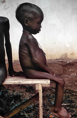 File:Starved girl.jpg