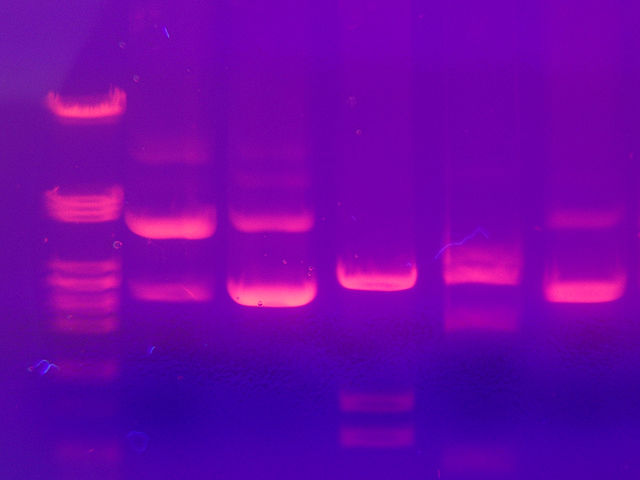 File:Gel electrophoresis 2.jpg